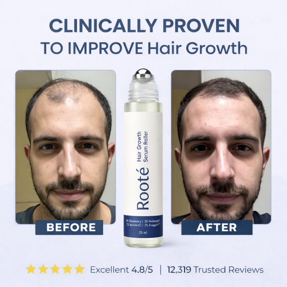 Rooté Hair Growth Roll-On Serum