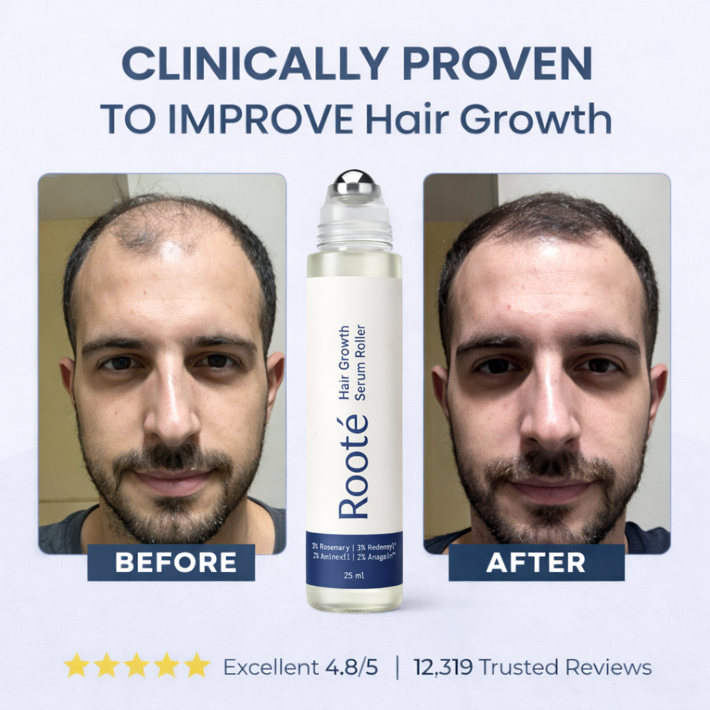 Rooté Hair Growth Roll-On Serum