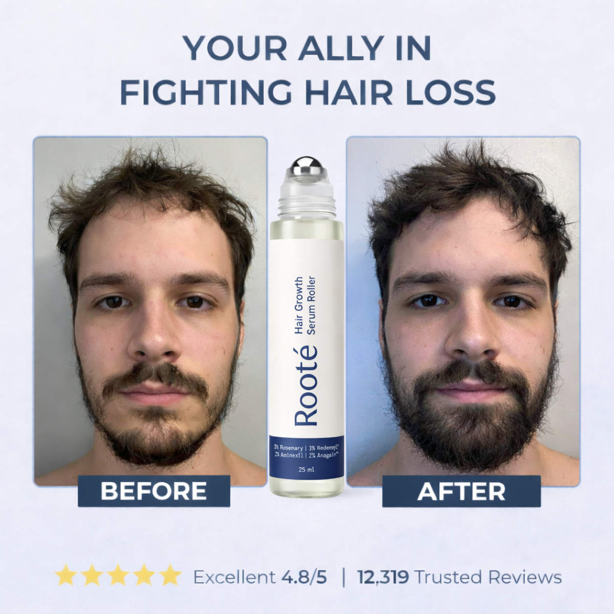 Rooté Hair Growth Roll-On Serum