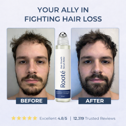 Rooté Hair Growth Roll-On Serum